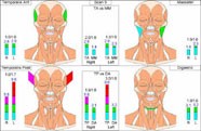 TMJ Expert Los Angeles TMJ Evaluation TMJ Dentist Los Angeles